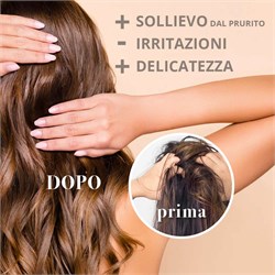 SHAMPOO LENITIVO MaterNatura