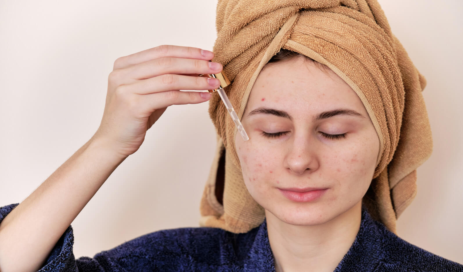Applicare siero oli essenziali sul viso contro l'acne