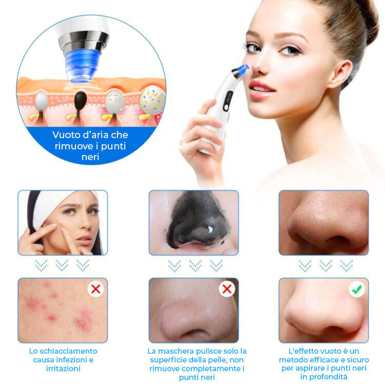 Makeup donna viso aspiratore punti neri, spedizione gratuita