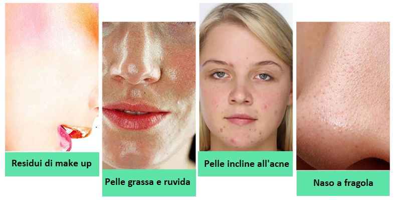 Dispositivo per residui di make up, pelle grassa e ruvida, incline all'acne, naso a fragola